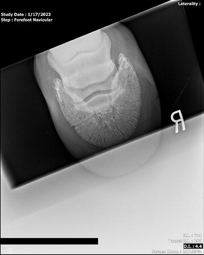 R Fore Navicular