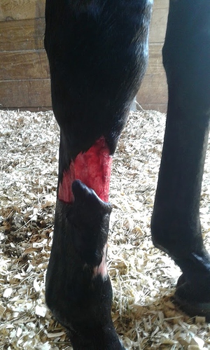 leg degloved xc 2