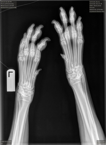 MetaCarpus Left DP