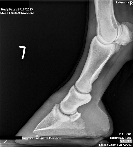 L Fore Navicular