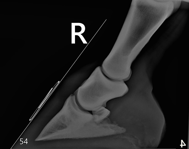 RF lateral