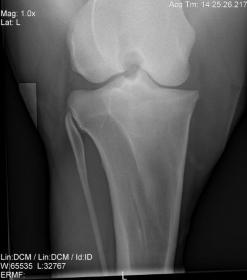 JXRAY 041619.jpg