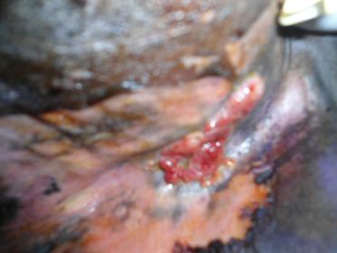 but its just a gap in the granulation tissue 8jun2015.jpg