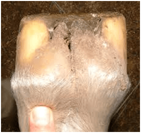 foot