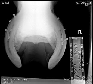 FOOT(RF)_NAVICULAR SKYLINE_821.jpg