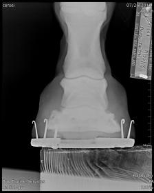 FOOT(LF)_PA_818.jpg