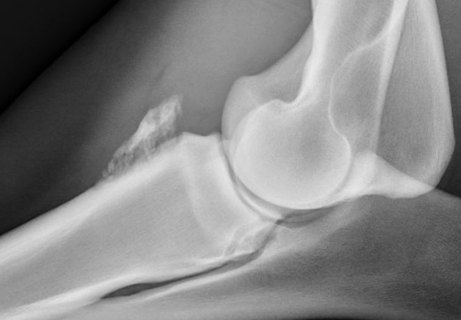 Ariel 06022017 elbow lat (2)